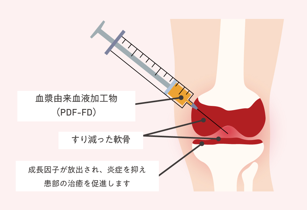 成長因子の働き